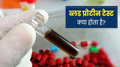 ब्लड प्रोटीन टेस्ट क्या होता है? जानें कब पड़ती है इस टेस्ट की जरूरत