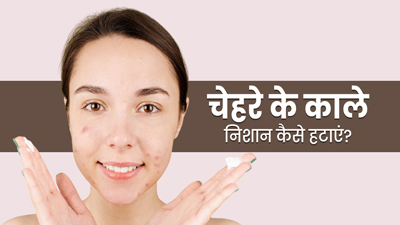 चेहरे के काले निशान कैसे हटाएं? जानें 5 घरेलू उपाय