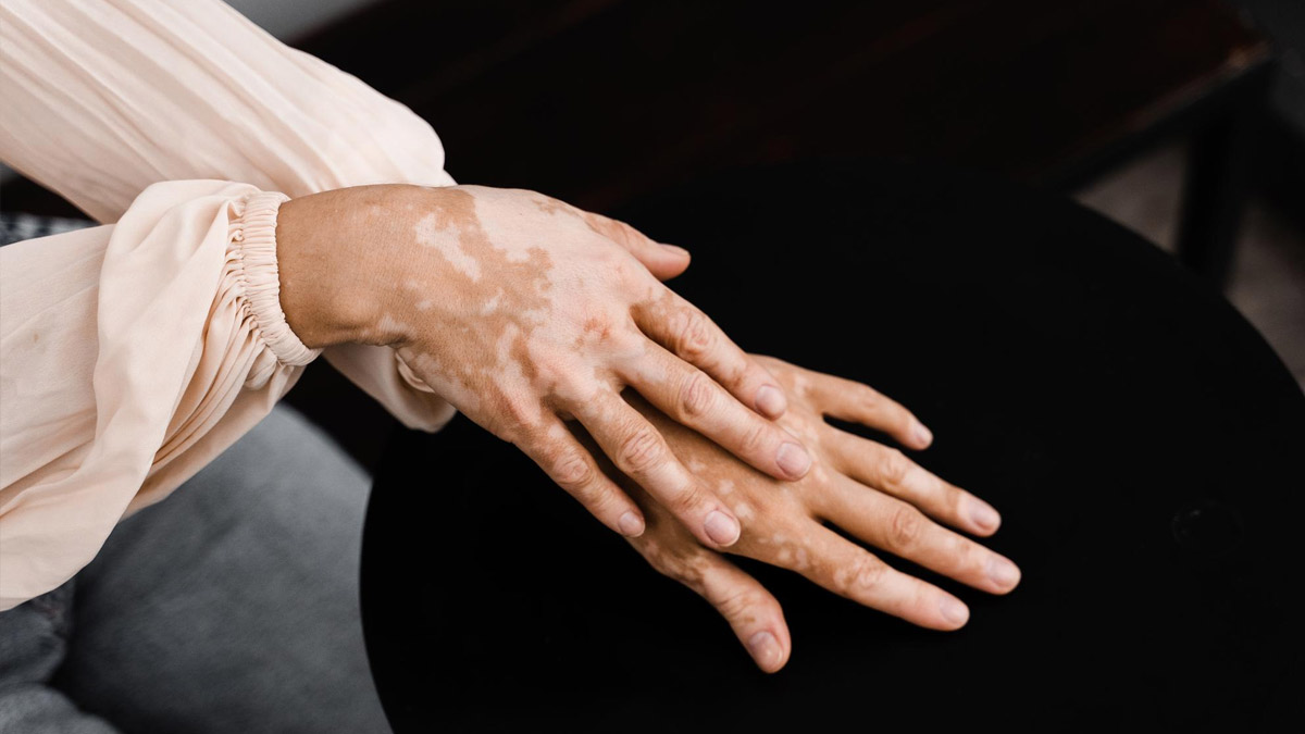  side effects of drinking milk with salt in Hindi