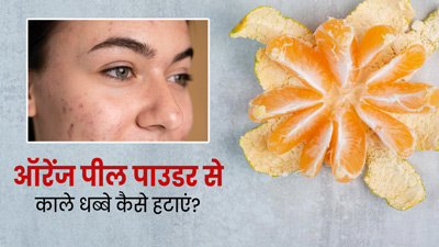 संतरे के छिलके के पाउडर से काले धब्बे कैसे हटाएं? जानें प्रयोग के 3 तरीके