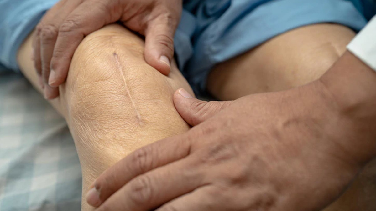 How To Manage And Treat Osteoarthritis 