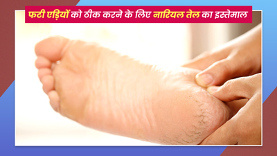 फटी एड़ियों से छुटकारा पाने के लिए नारियल तेल में मिलाकर लगाएं ये 3 चीजें