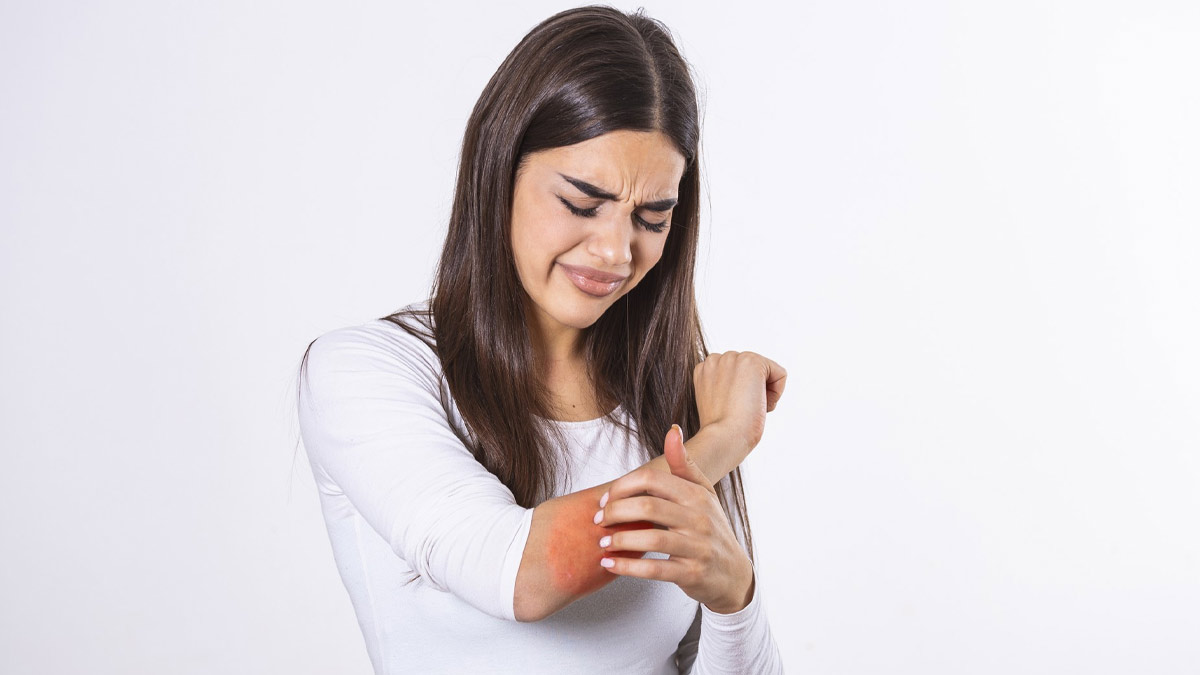 Home Remedies: स्वेटर पहनने के कारण स्किन पर हो रही है खुजली? इन घरेलू नुस्खों से पाएं राहत