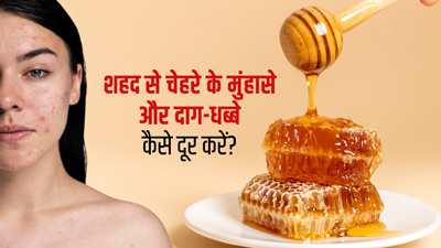 शहद से चेहरे के मुंहासे और दाग-धब्बे कैसे दूर करें? जानें 3 तरीके और पाएं बेदाग निखरी त्वचा