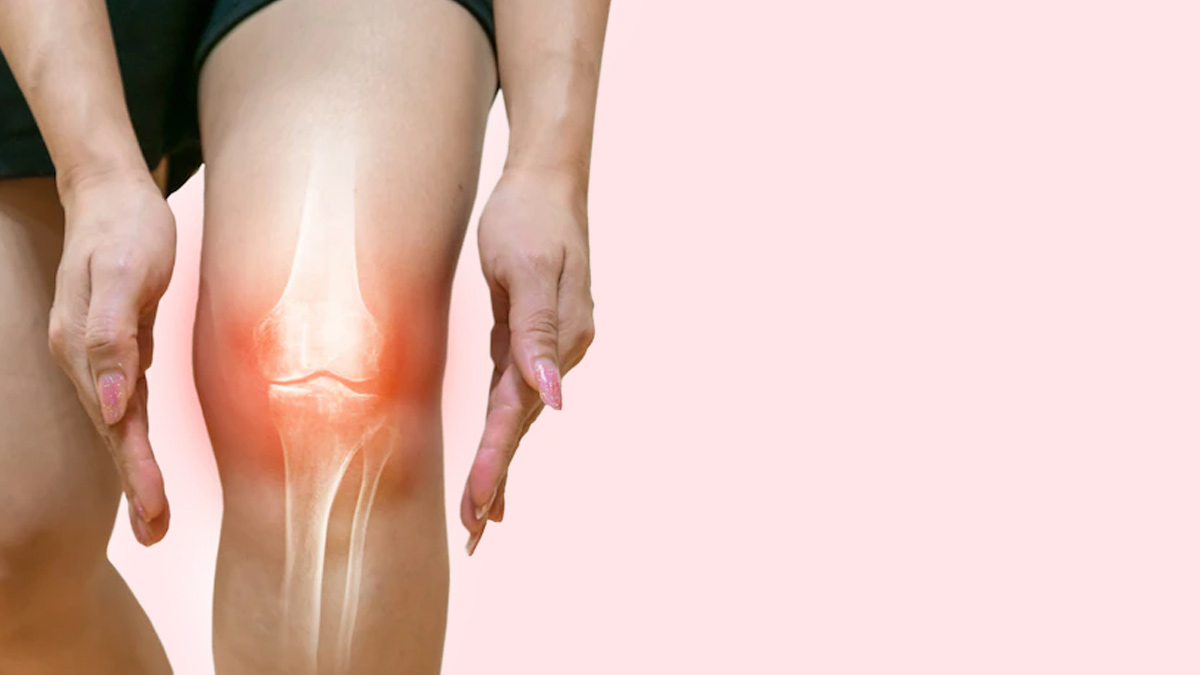 Expert Explains Causes And Treatment Of Osteoarthritis Onlymyhealth