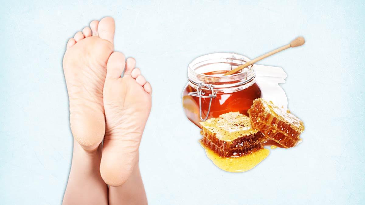 Learn How To Heal Dry, Cracked Feet Fast - Art of Skin Care
