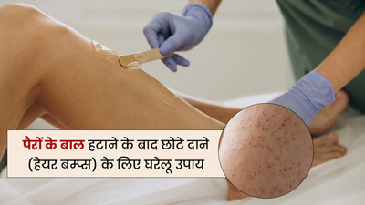 पैरों के बाल वैक्स करने के बाद आ गए छोटे दाने? जानें इसे हटाने के घरेलू उपाय