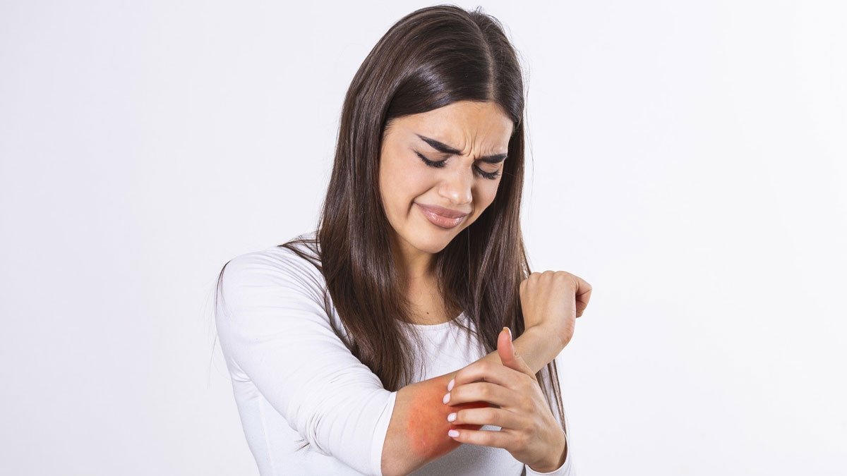 Home Remedy To Prevent Allergic Reaction