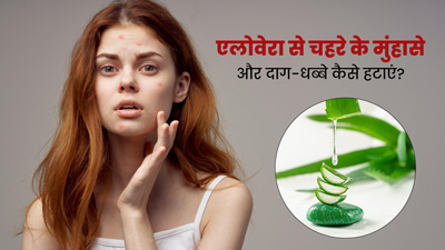 इस तरह चेहरे पर लगाएं एलोवेरा, दूर होगी मुंहासे और दाग-धब्बों की समस्या