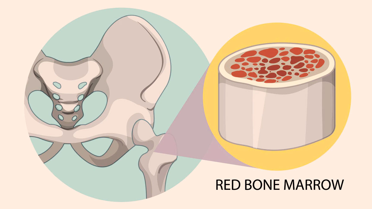 Bone Marrow Transplant Types, Procedure and Success Rate OnlyMyHealth