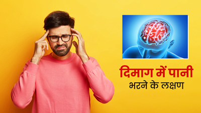 दिमाग में पानी भरने पर दिखते हैं ये 10 शुरुआती लक्षण, बिल्कुल न करें नजरअंदाज
