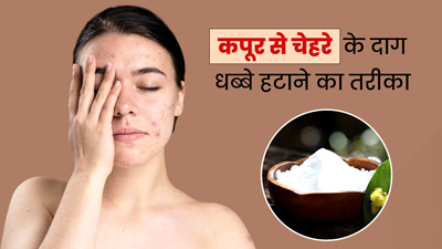 कपूर से हटाएं चेहरे के दाग-धब्बे, जानें इस्तेमाल के 3 तरीके