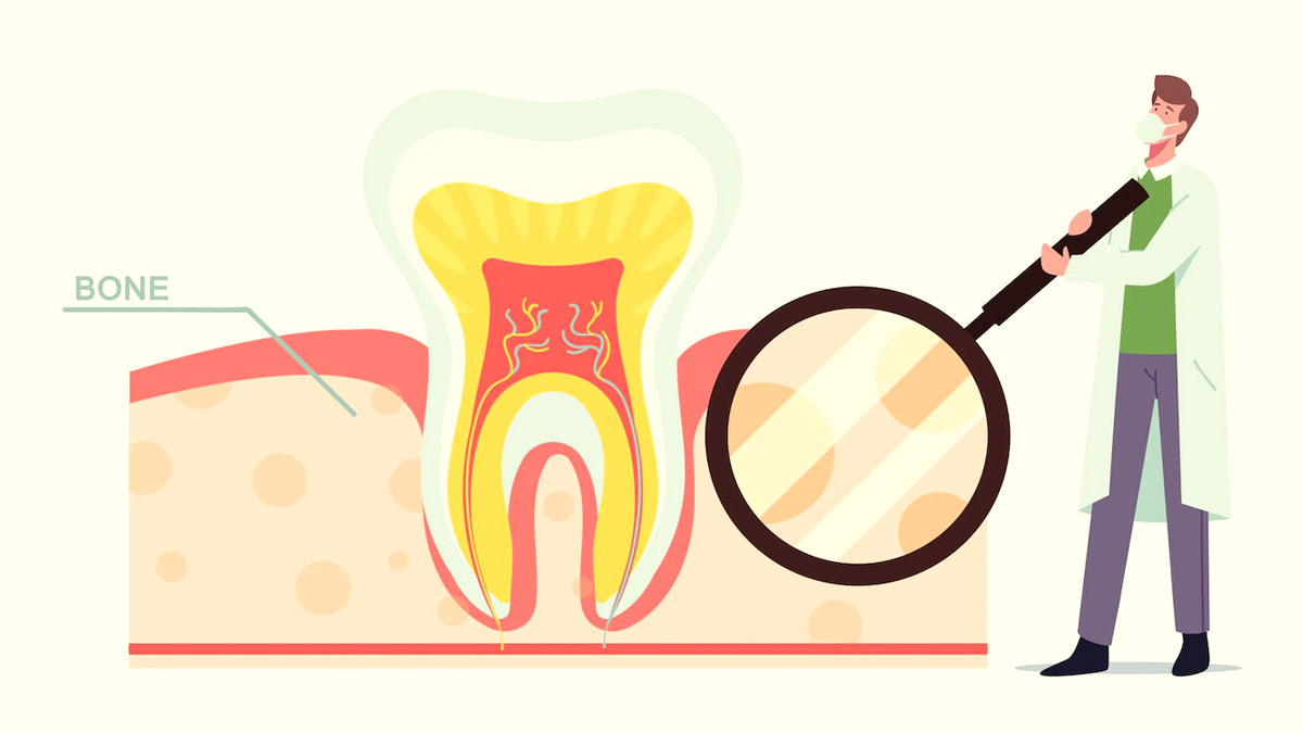 Tooth Root Resorption: Signs Of Damaged Teeth Roots You Should Never Ignore