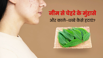 नीम की पत्तियों से चेहरे के मुंहासे और काले-धब्बे कैसे हटाएं? जानें प्रयोग के 3 तरीके