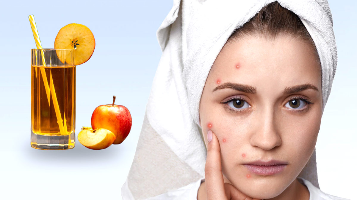 सेब के सिरके की मदद से दूर करें चेहरे के डॉर्क स्पॉट्स, जानें इस्तेमाल का तरीका