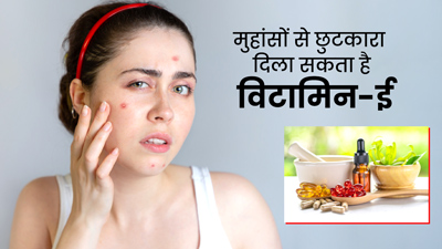 मुंहासों से छुटकारा दिला सकता है विटामिन ई ऑयल, जानें इस्तेमाल का तरीका