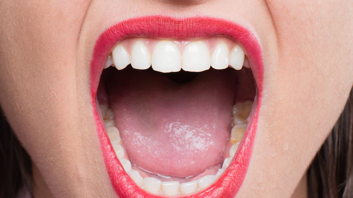 Excessive Saliva Production: What It Means For Oral Cavity, Expert ...