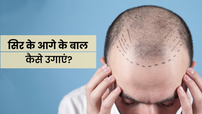 झड़ रहे हैं सिर के आगे के बाल? वापस उगाने के लिए लगाएं ये 5 चीजें
