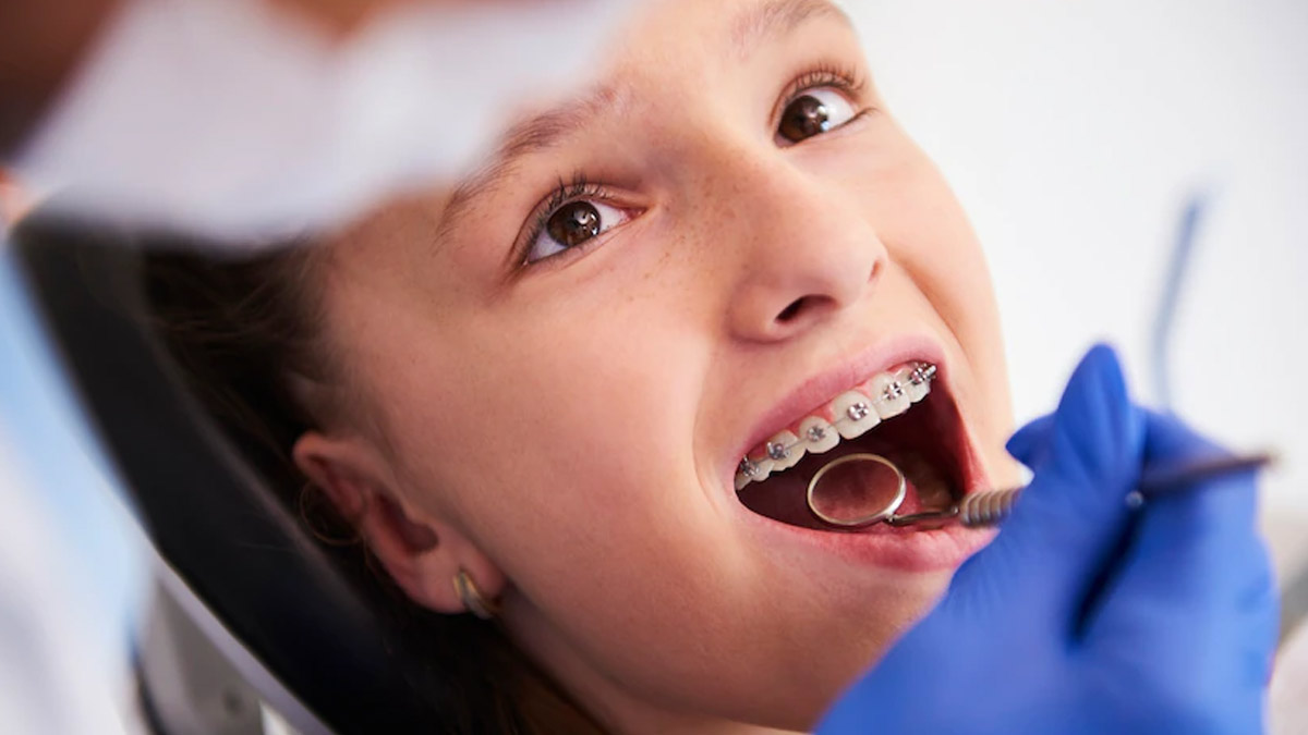 Orthodontics: Types Of Dental Treatment For Relief