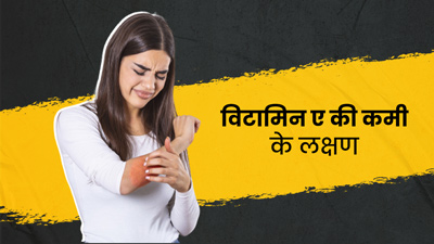 विटामिन ए की कमी होने पर दिखते हैं ये 6 लक्षण, जानें इसके लिए क्या खाएं