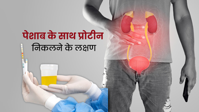 पेशाब में प्रोटीन आने पर दिख सकते हैं ये 7 लक्षण, किडनी फेलियर का हो सकता है संकेत