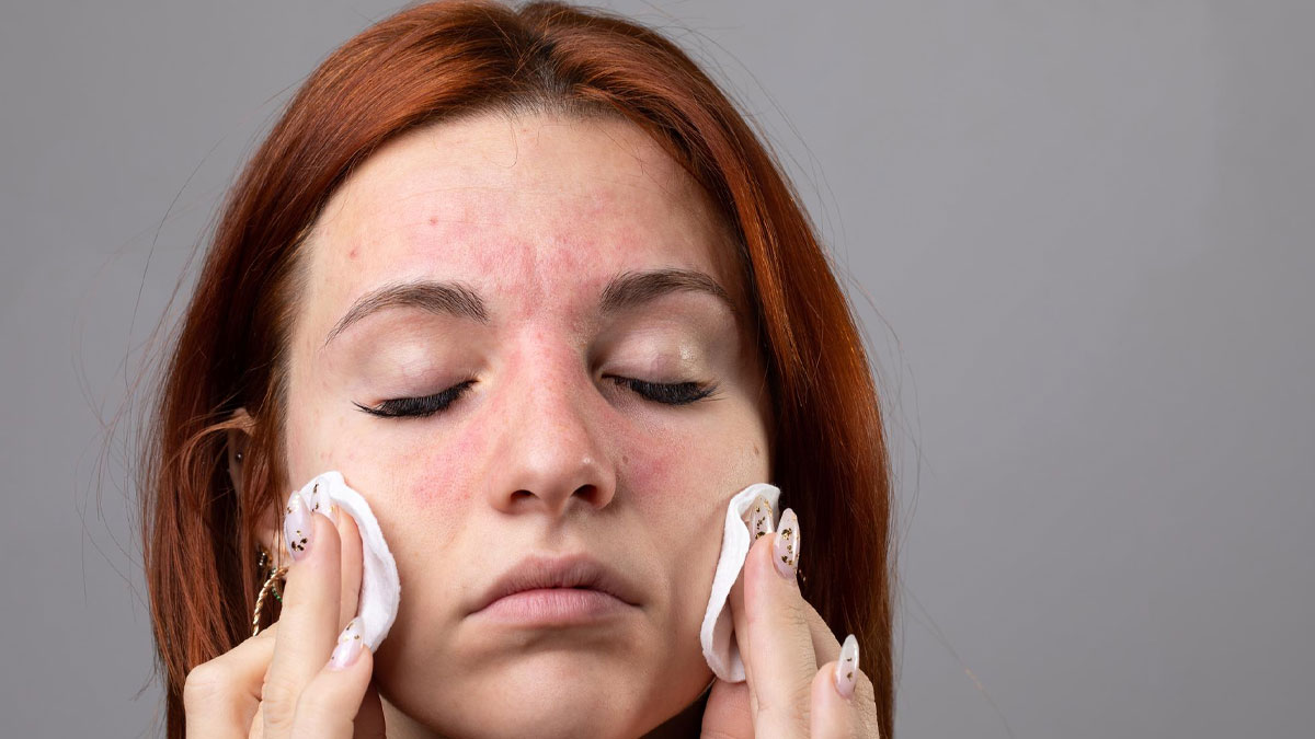 peel off mask side effects 
