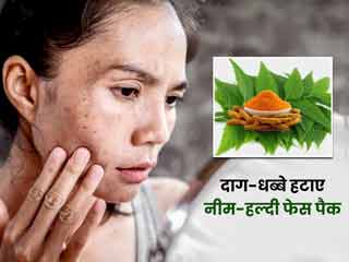 चेहरे के दाग-धब्बों को हटाने के लिए इस्तेमाल करें नीम और हल्दी का फेस पैक, मिलेंगे और भी कई फायदे