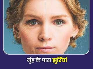 मुंह के आसपास नजर आने लगी हैं झुर्रियां, जानें इसके कारण और छुटकारा पाने के 5 तरीके