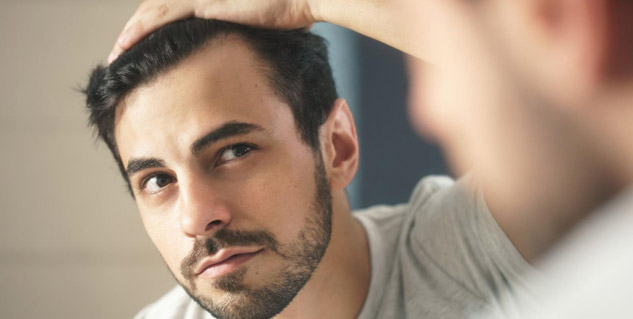 hair loss in men
