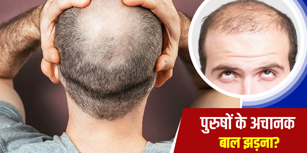 Sudden Hair Loss in Men Symptoms Causes and Prevention Tips in Hindi अचानक क्यों झड़ने लगते