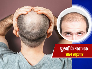 अचानक क्यों झड़ने लगते हैं पुरुषों के बाल? एक्सपर्ट से जानें इसके लक्षण और बचाव के उपाय