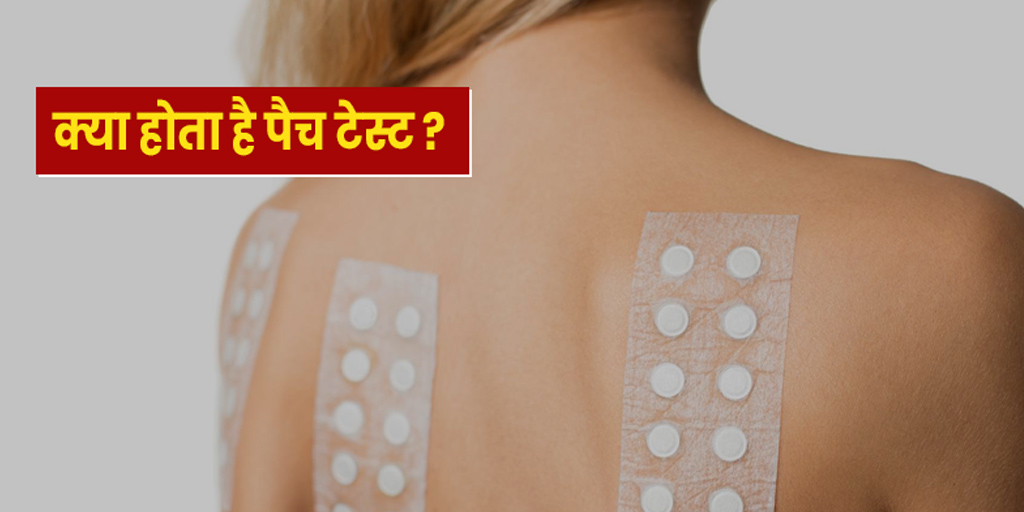 what-is-patch-test-know-everything-about-it-in-hindi