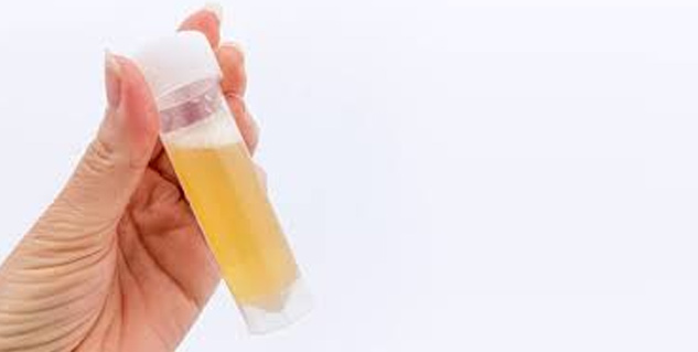 Symptoms, Causes And Risk Factors For Foamy Urine | OnlyMyHealth