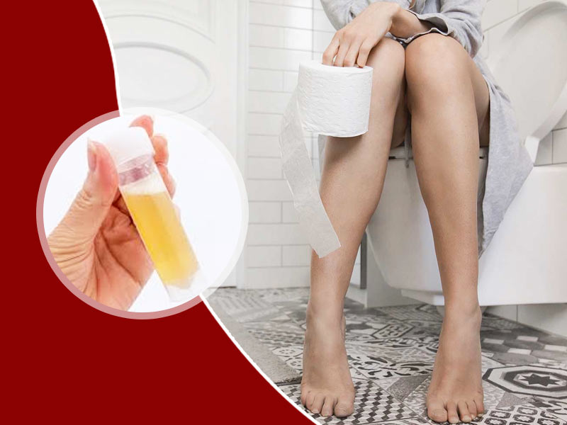 Symptoms, Causes And Risk Factors For Foamy Urine