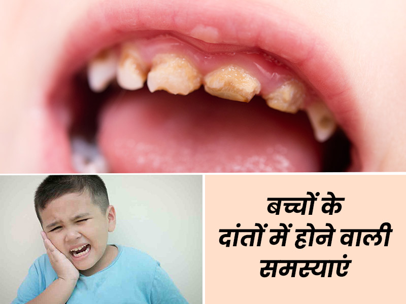 बच्चों के दांतों से जुड़ी इन 5 समस्याओं को नहीं करना चाहिए नजरअंदाज, सेहत पर पड़ सकता है असर