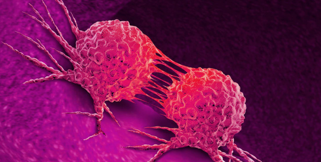 cancer
