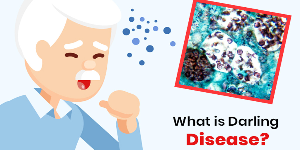 What Is Darling Disease