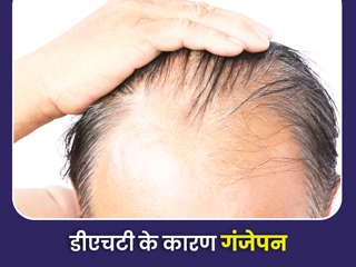 डीएचटी (DHT) के कारण गंजेपन के शिकार हो सकते हैं आप, जानें क्या है ये