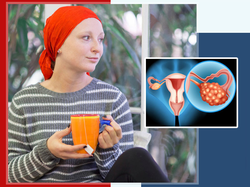World Cancer Day 2022: Ovarian Cancer Patients Must Keep These Things in Mind