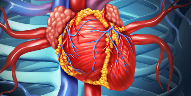 heart surgery