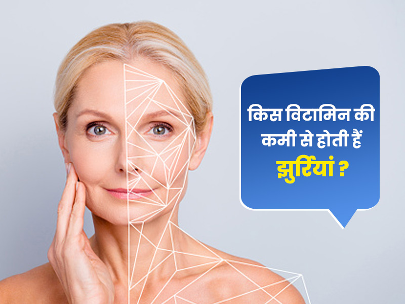 किन विटामिन्स की कमी से होती हैं स्किन पर झुर्रियां? एक्सपर्ट से जानें इसे दूर करने के उपाय