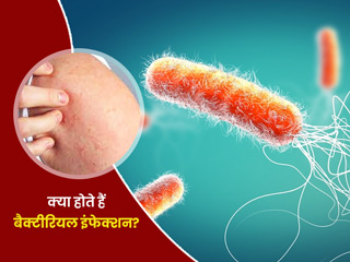 कई तरह के होते हैं बैक्टीरियल इंफेक्शन, जानें इनके कारण, लक्षण और बचाव के उपाय