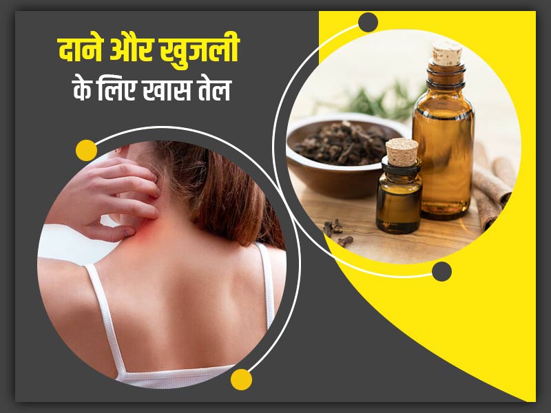 शरीर में दाने और खुजली से छुटकारा पाने के लिए सोने से पहले लगाएं ये देसी तेल,  जानें बनाने का तरीका