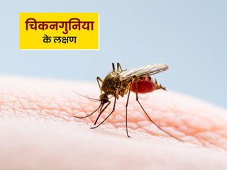 चिकनगुनिया के लक्षण क्या हैं? जाने इसके कारण और इलाज के तरीके