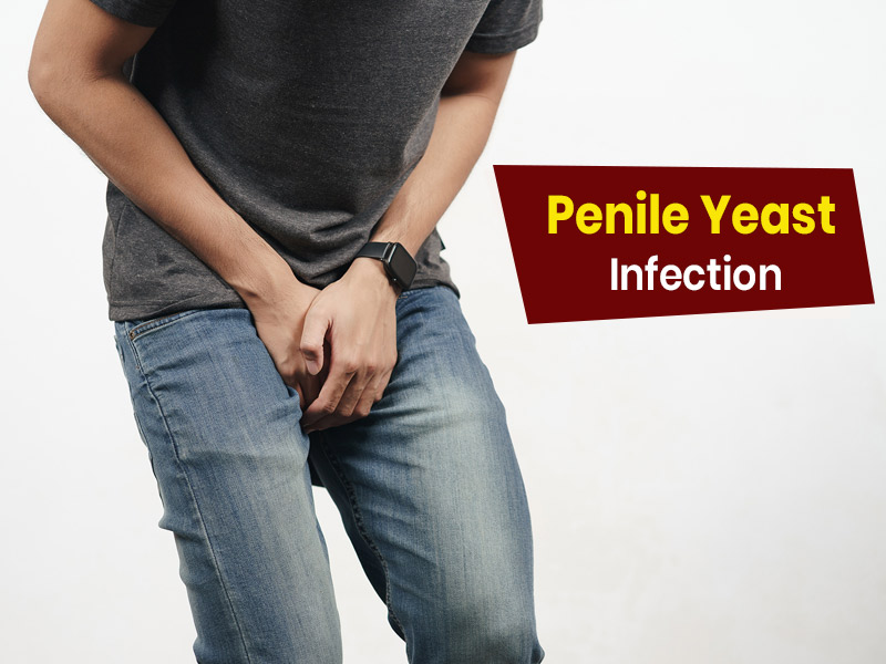 Yeast Infection In Men: Symptoms, Causes And Risks Of Penile Yeast Infection