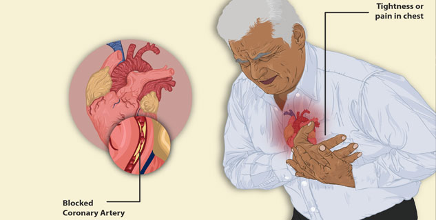 heart blockage causes