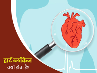 हार्ट ब्लॉकेज क्यों होता है? जानें हार्ट में ब्‍लॉकेज होने पर क‍िन बातों का रखें ख्‍याल