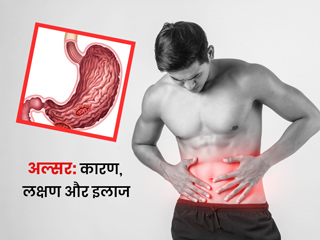 पेट में अल्सर के कारण, लक्षण और इलाज, डॉक्टर से जानें इस बीमारी के बारे में