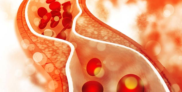 Inside_highcholesterol