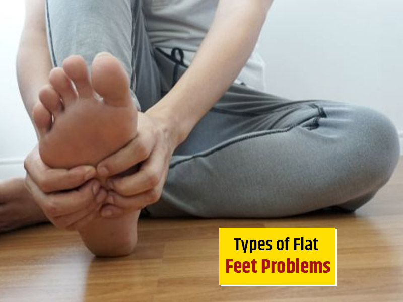 Flat Feet Condition: Know Types And Tips For Treatment